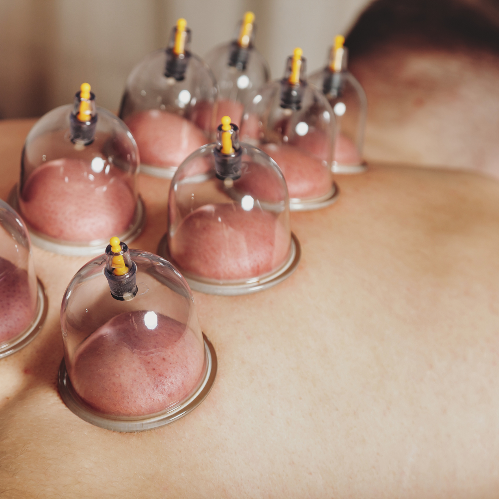 Cupping Massage