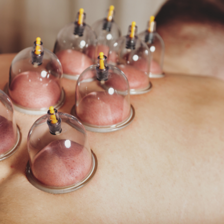 Cupping-Massage-768x768